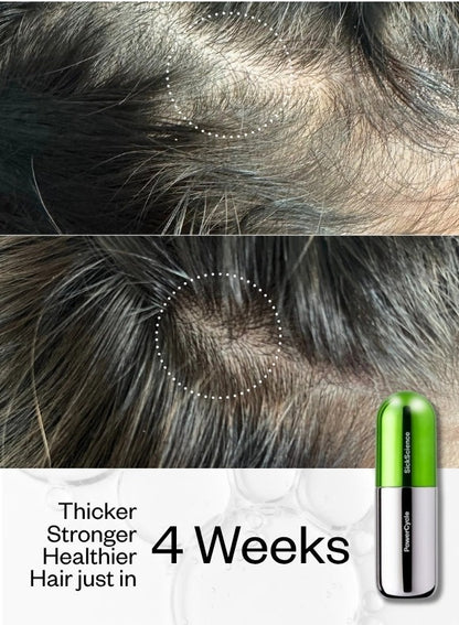 PowerCycle Exosome Scalp Serum for Hair Growth and Scalp Health | Advanced Scalp Treatment for Thinning Hair & Healthy Regrowth - Lightweight Scalp & Hair Growth Serum for Women & Men - 60mL