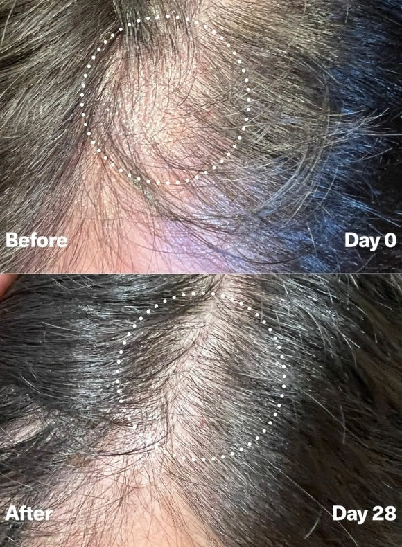 PowerCycle Exosome Scalp Serum for Hair Growth and Scalp Health | Advanced Scalp Treatment for Thinning Hair & Healthy Regrowth - Lightweight Scalp & Hair Growth Serum for Women & Men - 60mL