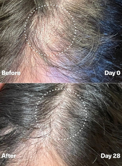 PowerCycle Exosome Scalp Serum for Hair Growth and Scalp Health | Advanced Scalp Treatment for Thinning Hair & Healthy Regrowth - Lightweight Scalp & Hair Growth Serum for Women & Men - 60mL