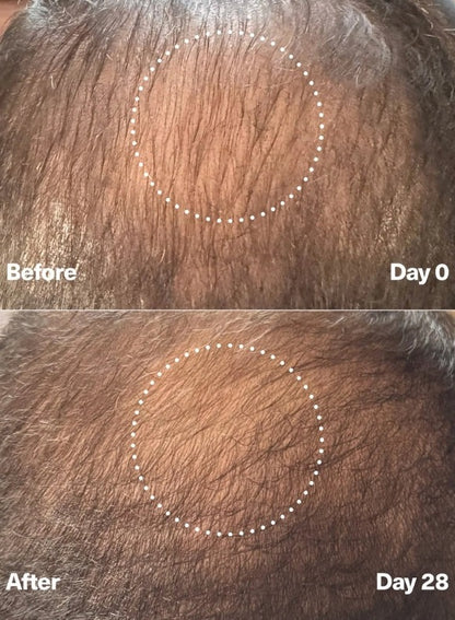 PowerCycle Exosome Scalp Serum for Hair Growth and Scalp Health | Advanced Scalp Treatment for Thinning Hair & Healthy Regrowth - Lightweight Scalp & Hair Growth Serum for Women & Men - 60mL